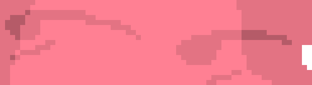 [8048ed] i know multiple people eventually led you to rip it out, but i'm till confused on how you didn't have some sort of internal conflict like "do i really want to ruin my quality of life after all of this?"