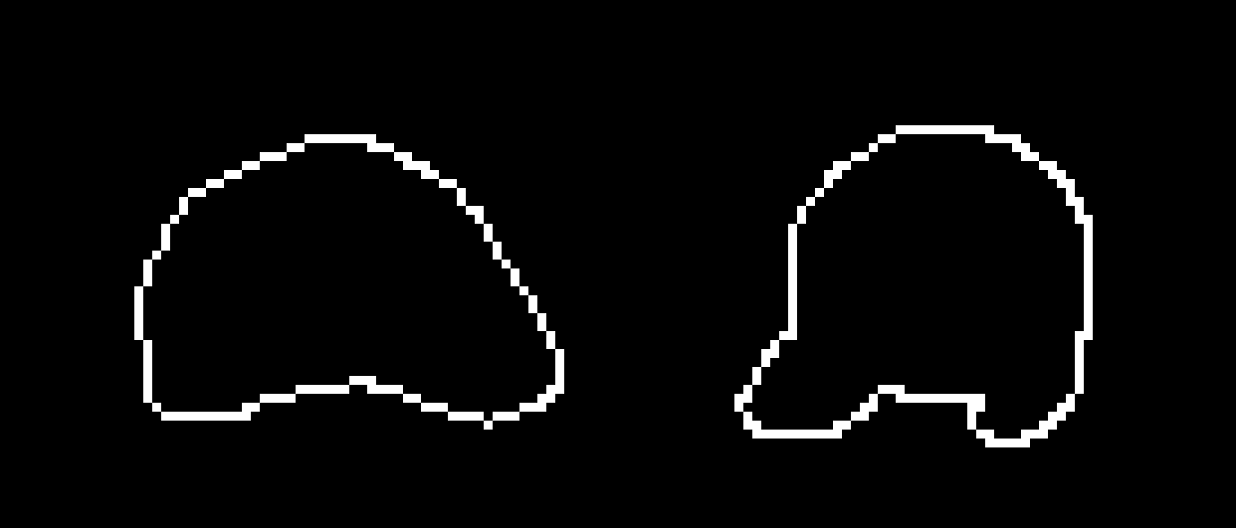 [77b851] Observe figure A and B, Figure A is a totally normal ribcage and Figure B looks like someone just yanked the bottom of it, thats me.. [Noone yanked it like that I was just born like that for some reason] | -Grim