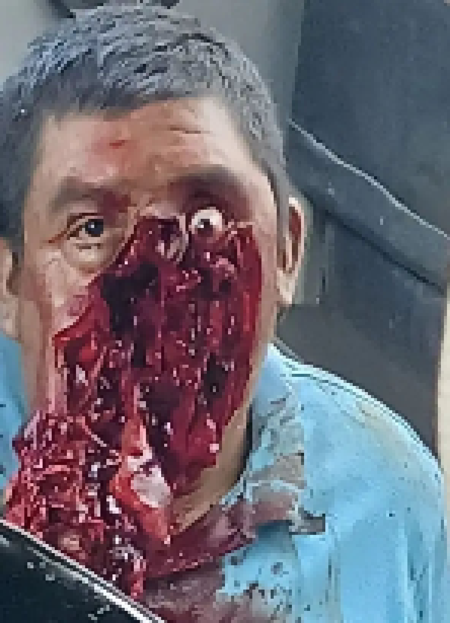 [061c6e] More goreeeeee.