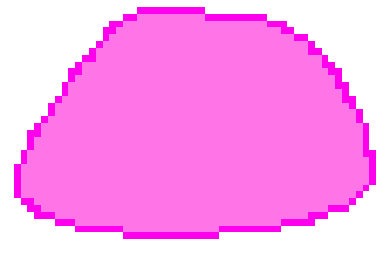 [a34ade] "never thought i would have to use this again.. Radiophobia!"