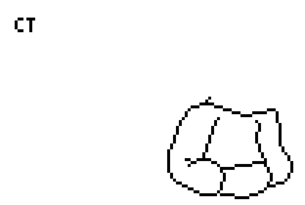 [2d73ea] Ct-pai, I think you need help with this, -jase