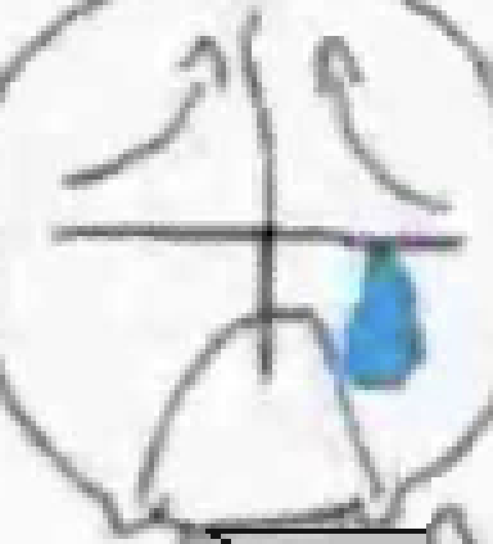 [acbc50] *rip sad grunt*