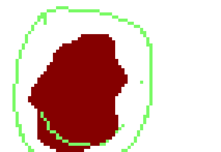 [caa9ae] your eye is now super jacked