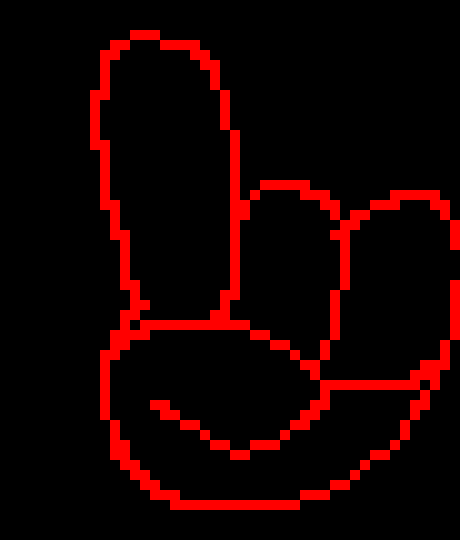 [7bdf73] Two Bitch+- It usually happens because of an injury or illness, but can also happen with no known cause (spontaneous). 