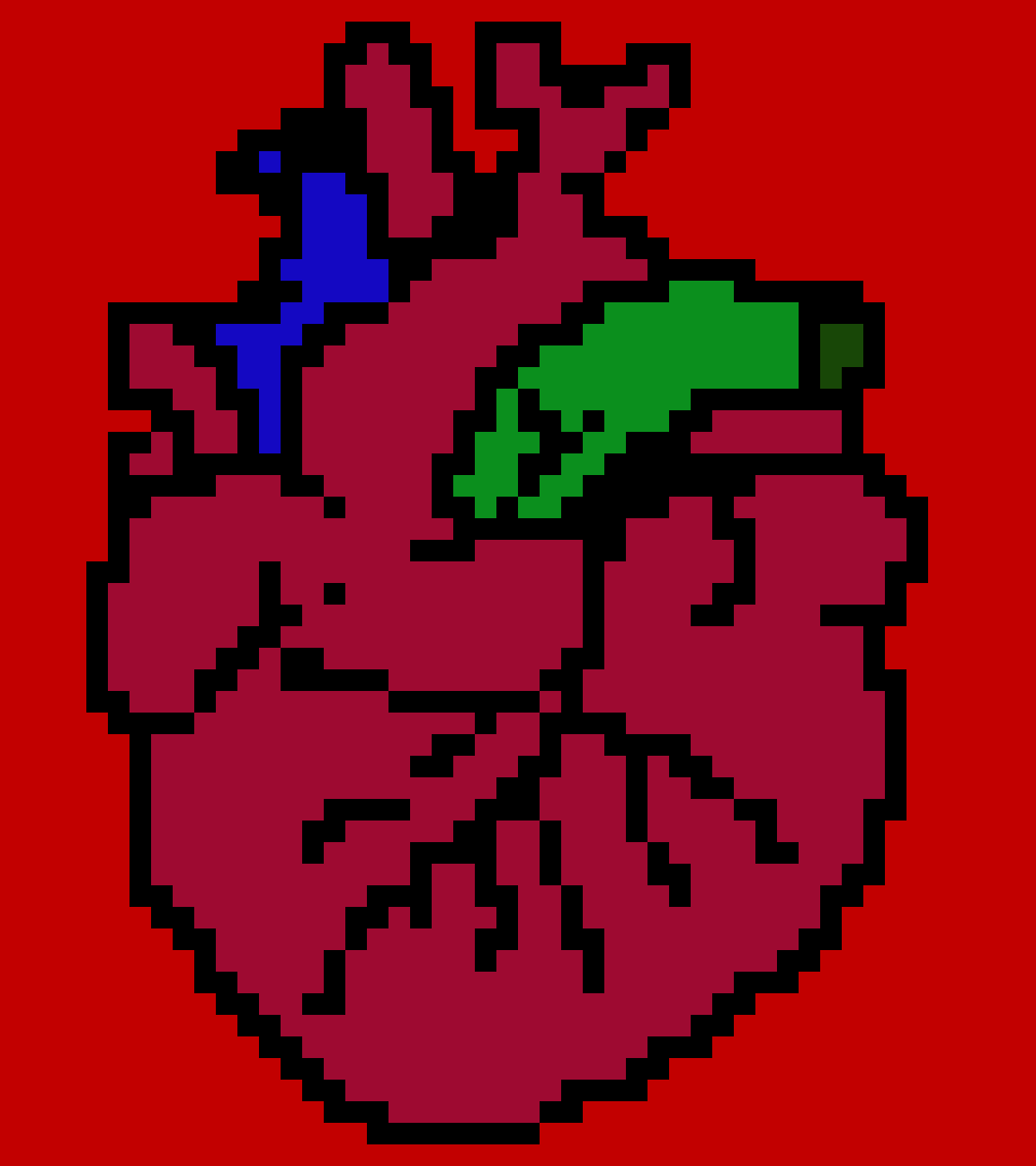 [9664c4] HearT2