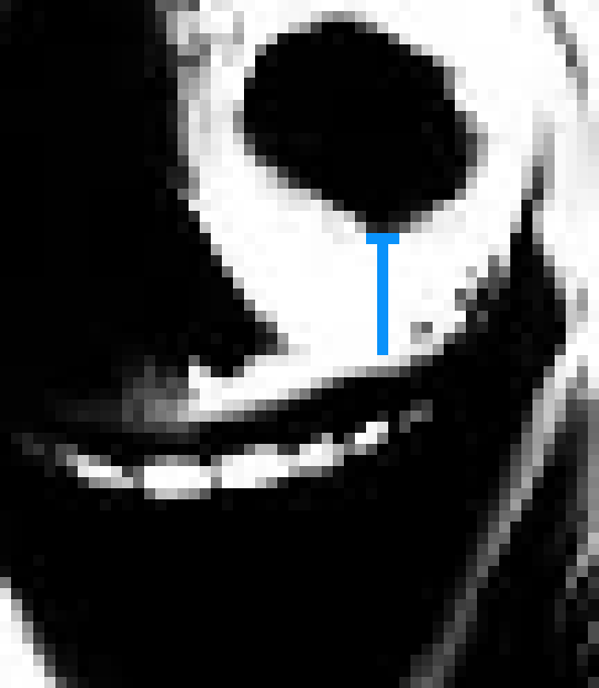 [b63bdb] why me  *https://www.youtube.com/watch?v=skQIbVBhicE*