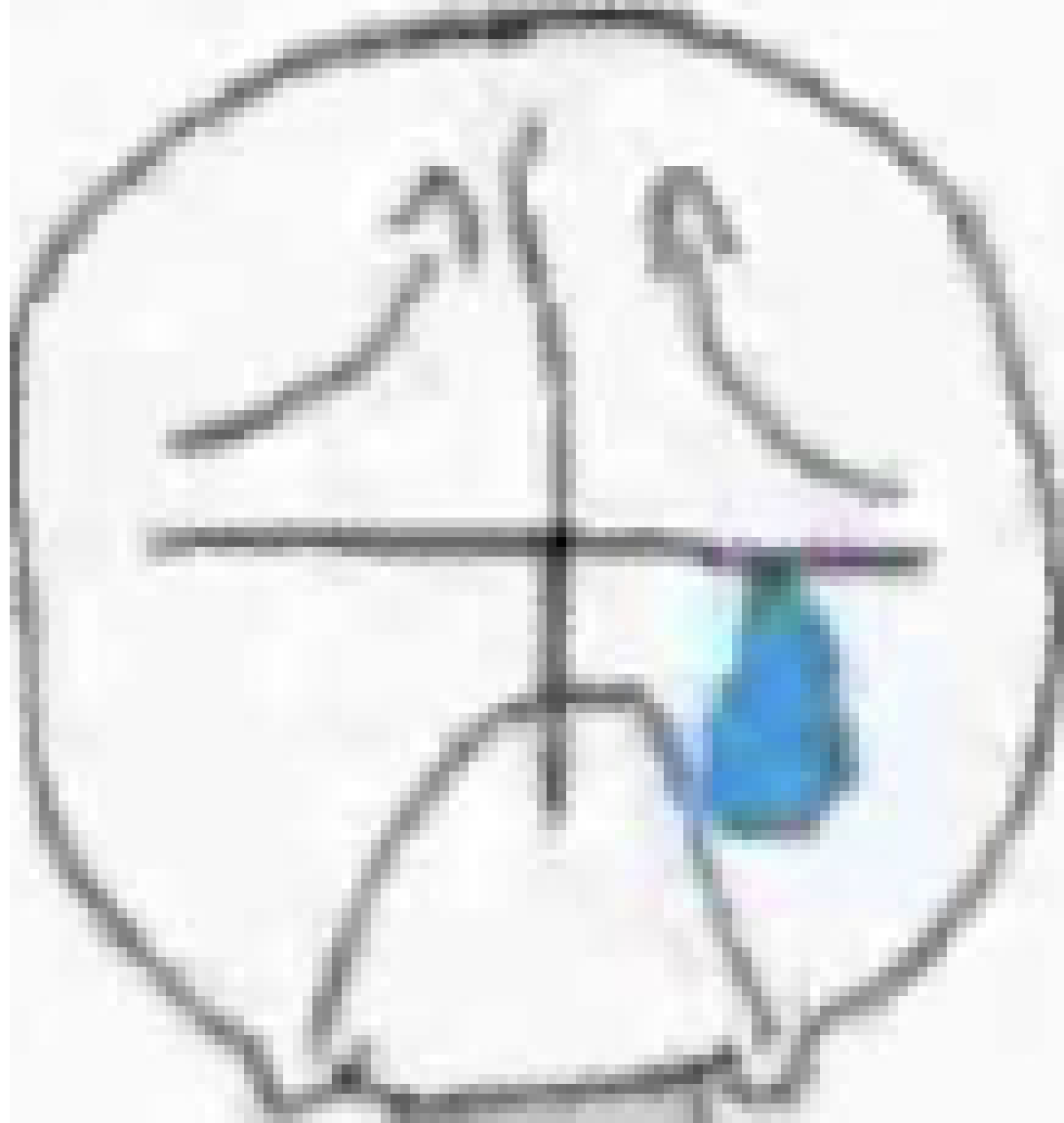 [acbc50] Please end my sadness and pain