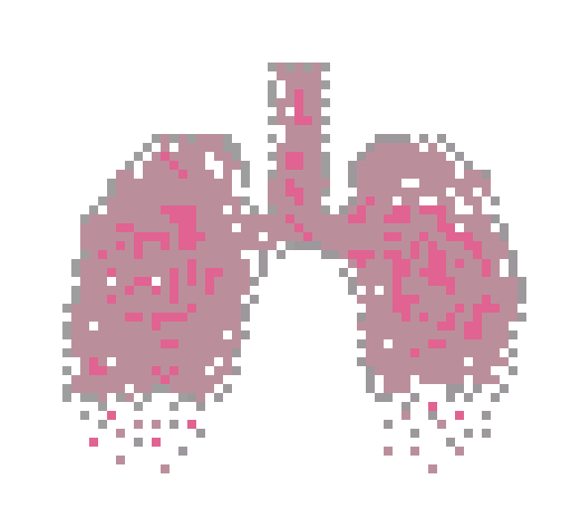 [9664c4] lungs