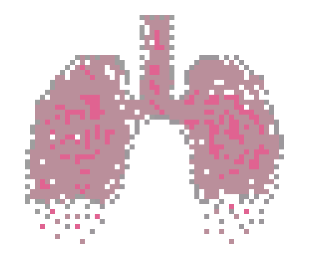 [9664c4] lungs