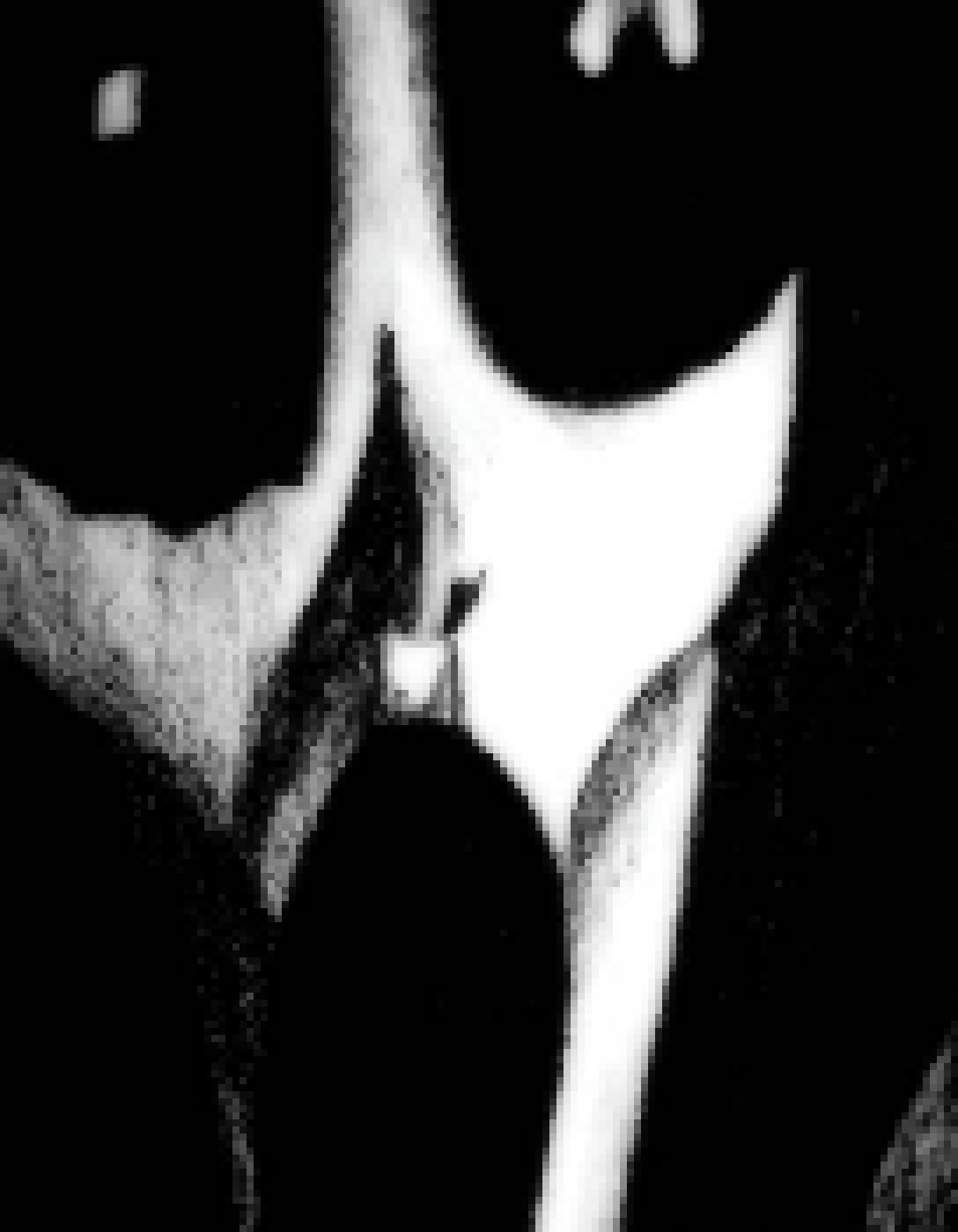 [46bd03] dip youre balls in the fryer and you will take youre place in the new era