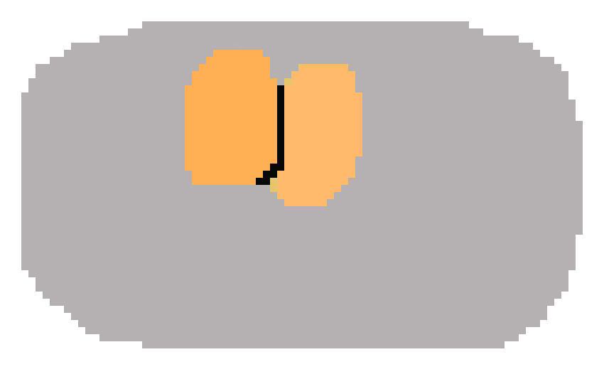 [2410ca] Plate with eggs on it 