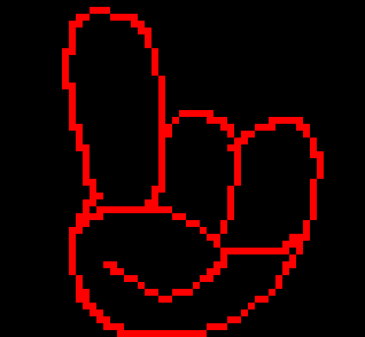 [12bf7e] Two Bit+- Bmo, Pee with a sugary or fruity fragrance can serve as a warning sign of diabetes or hyperglycemia (high blood sugar), 