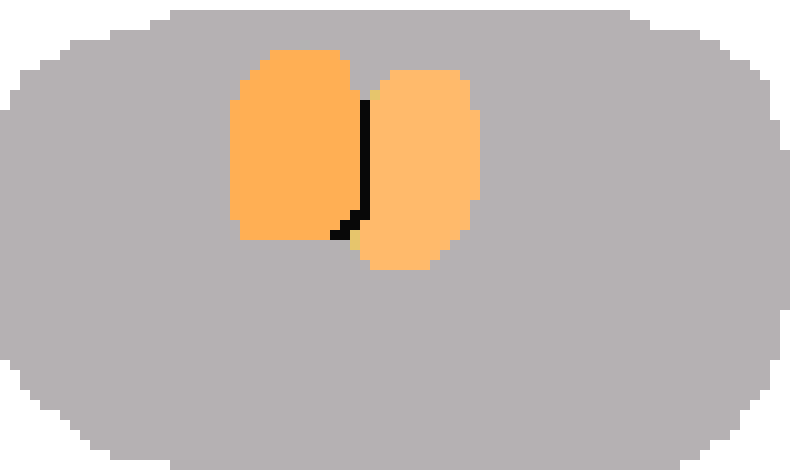 [2410ca] Plate with eggs on it 