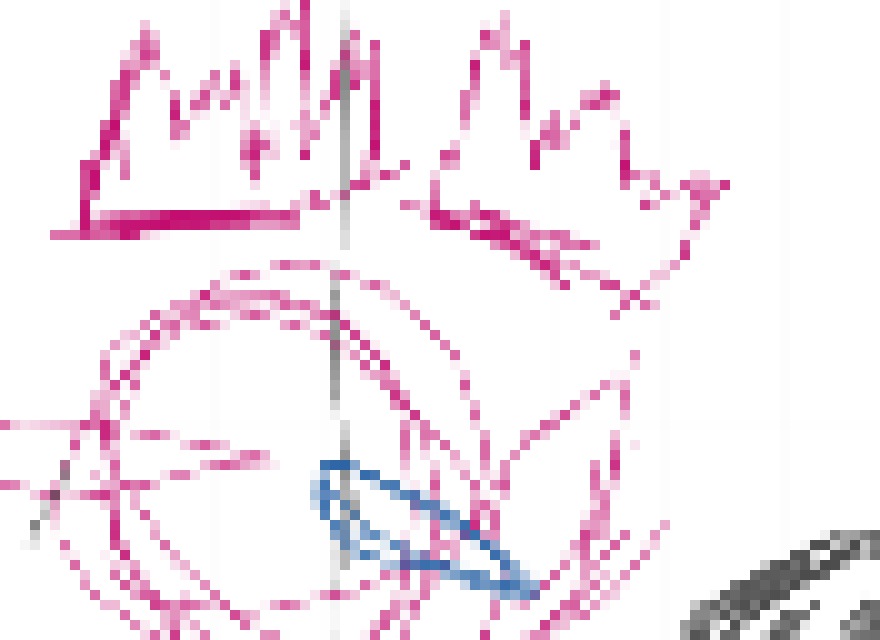 [1928f9] Like no honestly most of the shit you say, i can't anwser it without having a brain an eurysm