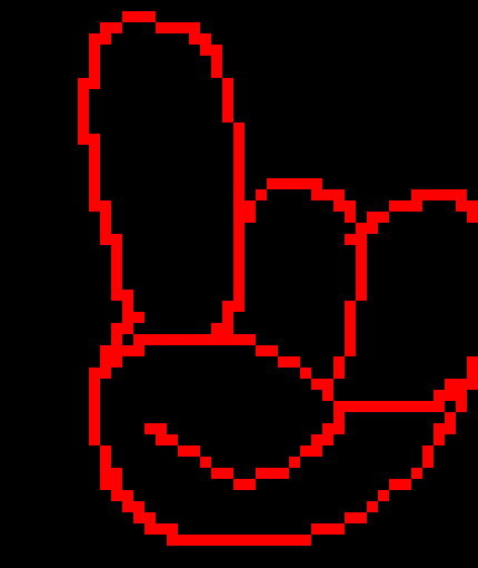 [7bdf73] Two Bitch+-  Its called Pneumomediastinum is air or gas in the space between your lungs (mediastinum).