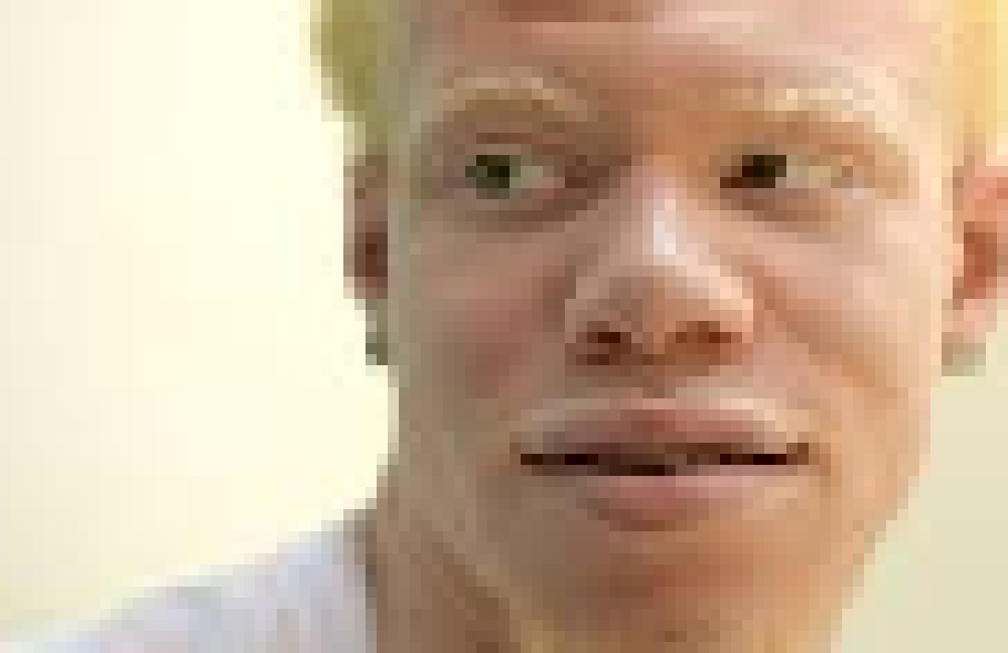 [d77e03] there's albino people now