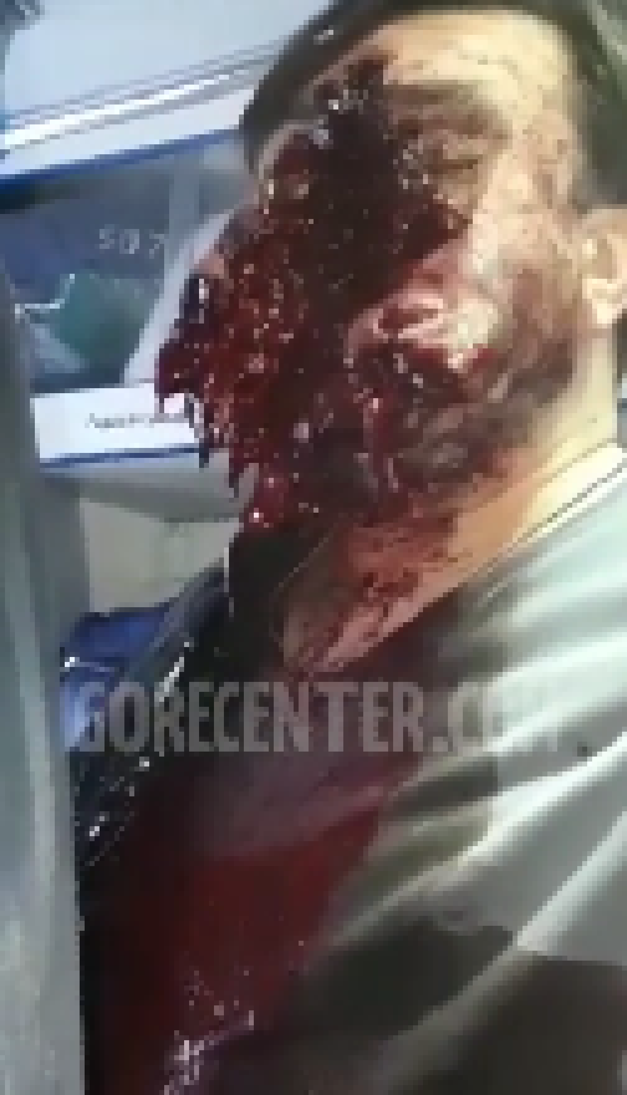 [4a11cf] lots of ids yall gonna be blocking, reminder, this will be daily, and id changes so get used to gore yall!