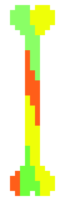 [9664c4] Sans bone attack