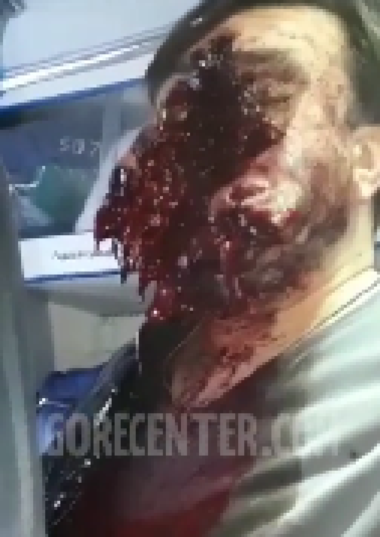 Block me ALL you fucking want proxies work and heres your SECOND dose of gore.