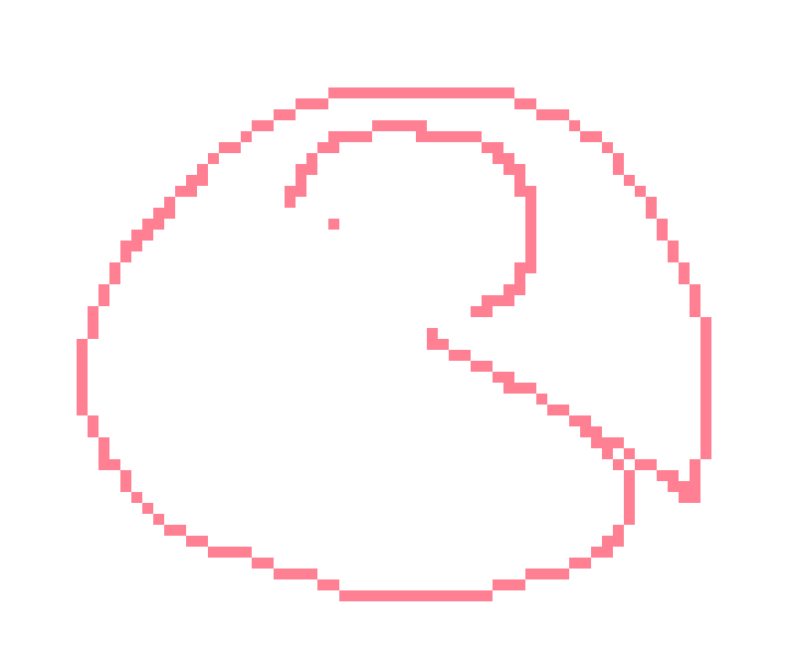 [6650bb] bro GET THAT CHECKED OUT, I DON'T GIVE A SHIT IF IT ALWAYS GOES AWAY