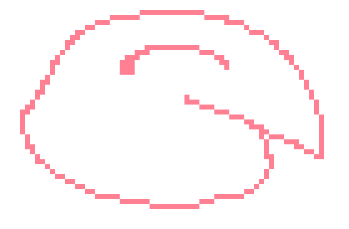 [6650bb] how would you even fucking do that