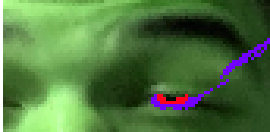 [236914] you massacred my beautiful face