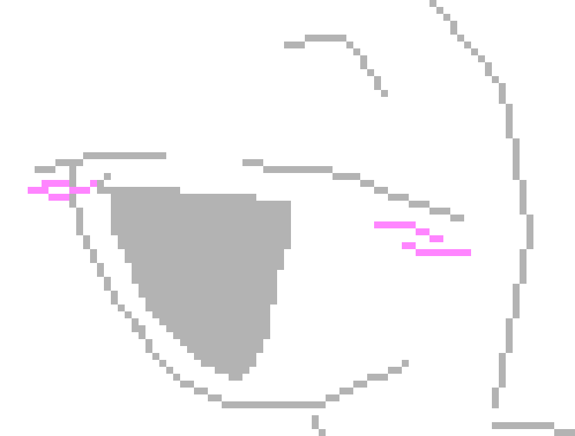 [894f74] sinus headache