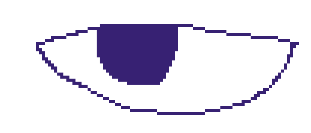 [56da69] Around the elbow area the forearm gets bigger and then it shrinks until it reaches the wrist.