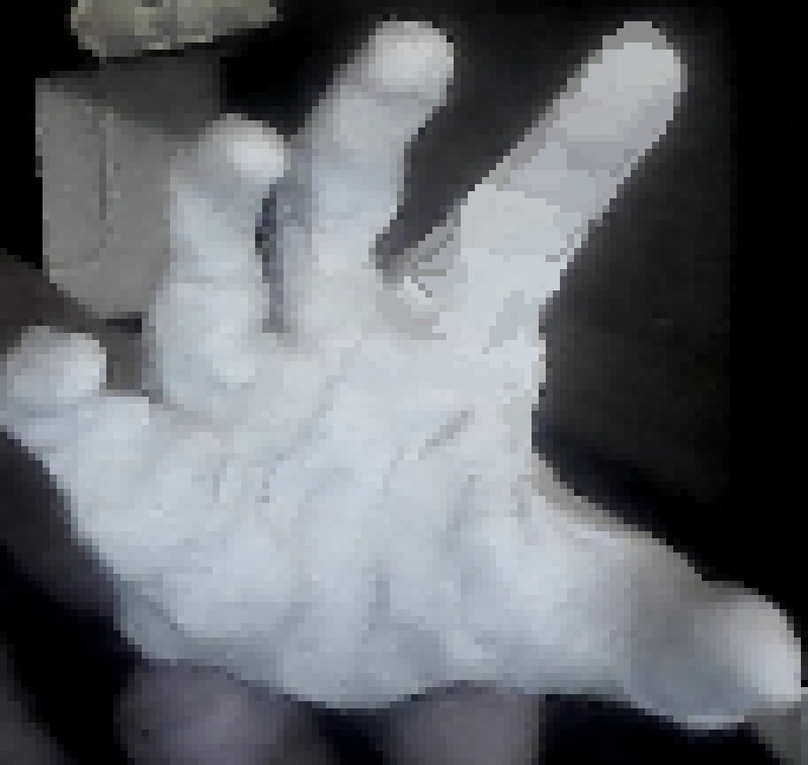 [925deb] the poop disability 