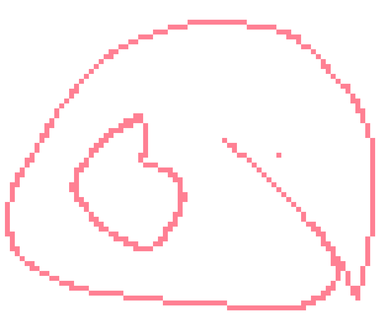 [a0925b] oh wait that's just an asthma attack