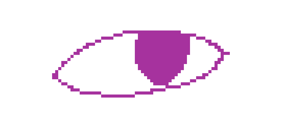 [56da69] What if a random guy outside, probably drunk out of his mind, chucked a brick through your window. You die, go to the hospital, they cant save you. If you think its not fair that he was able to decide wether you lived or not, why should you be able to decide wether your brother lives or not?