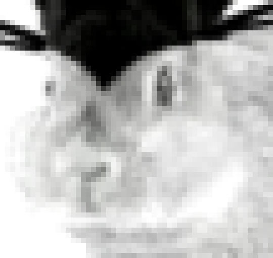 [f5254f] I have eadache