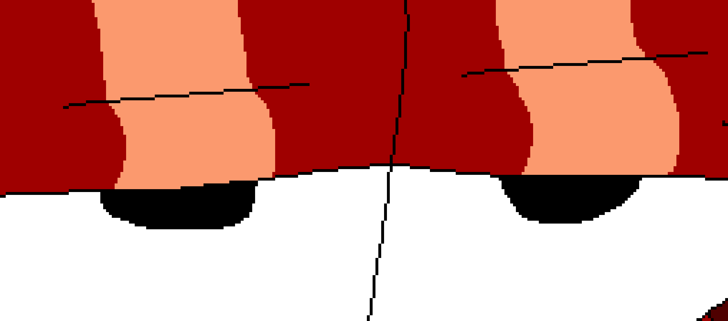 Stupid looking eyelids 6