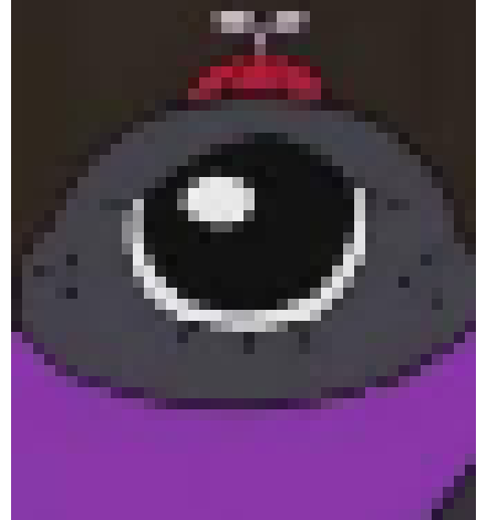 [236914] my ankle hurt