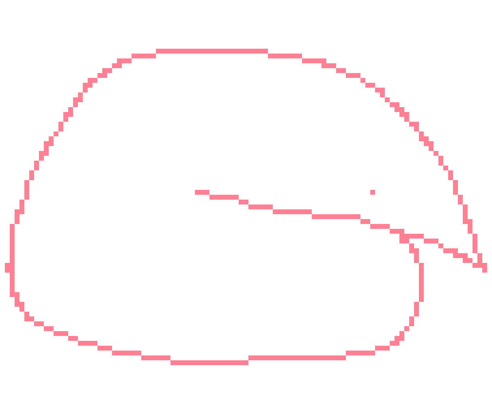 [a0925b] i would not but ok