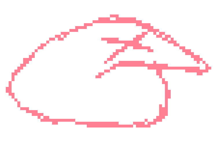 [a0925b] dies of skibidi skill issue