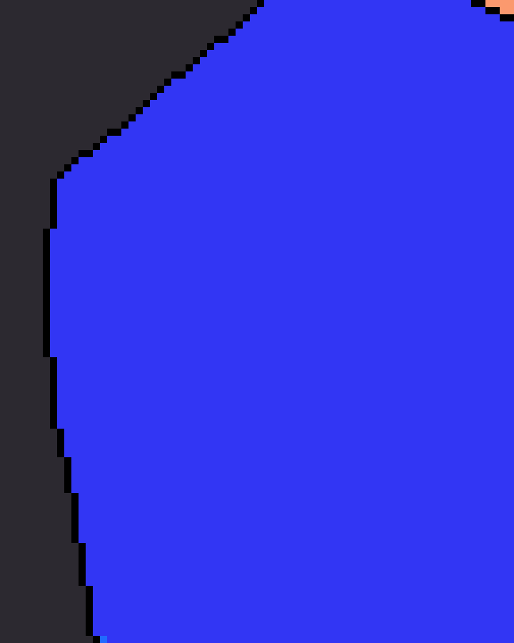 Stupid looking eyelids 7